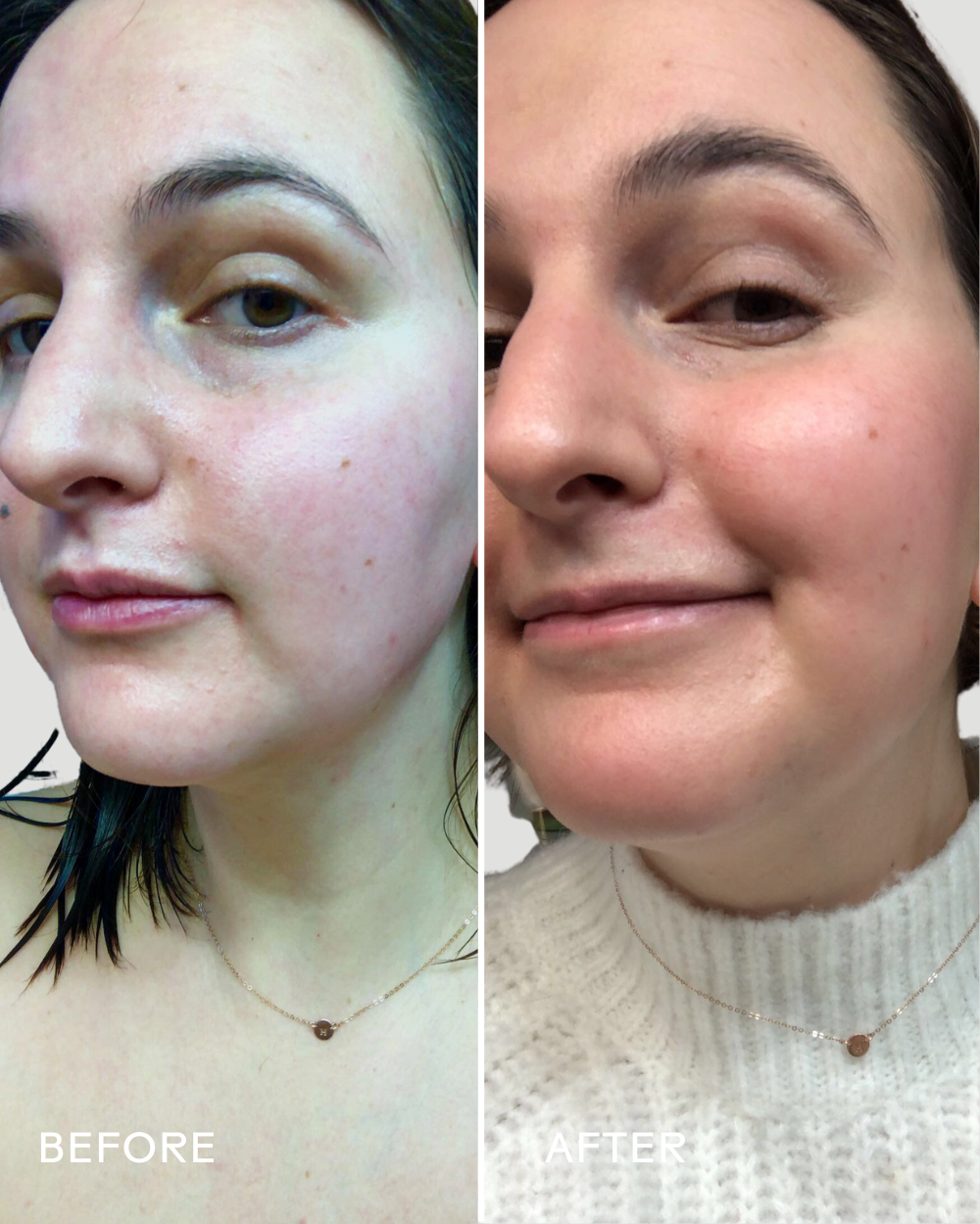 SkinHero™ Calendula + 2% Bakuchiol Bio-Retinol Serum | Three Ships