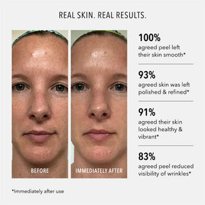 Polish & Plump Face Peel Kit | HydroPeptide