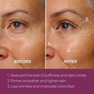 Close-up before and after comparison of a woman's eye area showing reduced puffiness, dark circles, firmer smoother skin, and fewer wrinkles using Eye Repair Peptide Complex | blinc.
