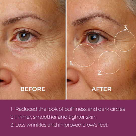 Close-up before and after comparison of a woman's eye area showing reduced puffiness, dark circles, firmer smoother skin, and fewer wrinkles using Eye Repair Peptide Complex | blinc.