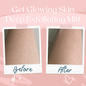 Comparison of skin texture on a leg before and after using the DEEP Exfoliating Mitt | Dreambox Beauty, showing smoother and glowing skin after exfoliation.