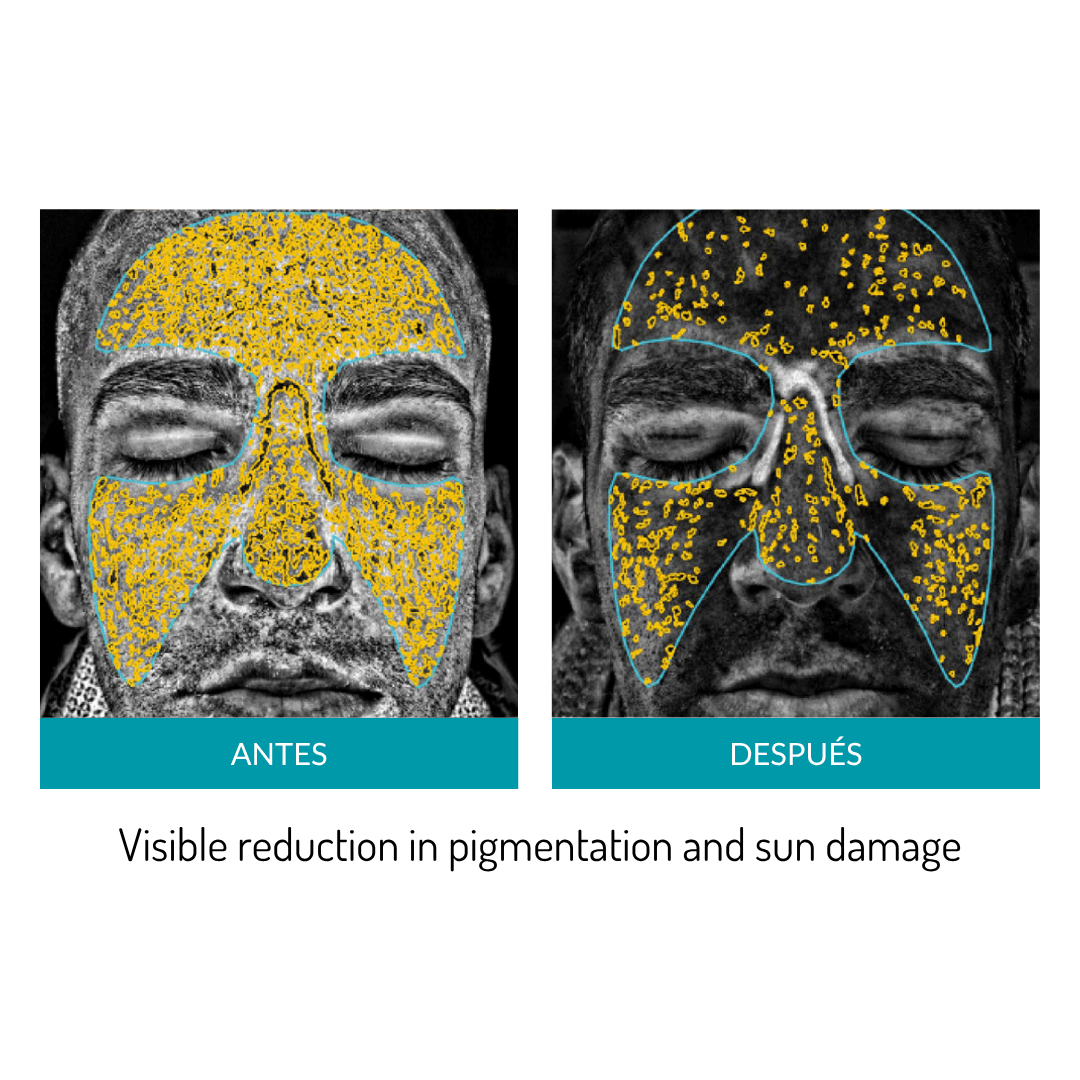 Glo Mask Anti-Aging LED Phototherapy Mask | Glo910