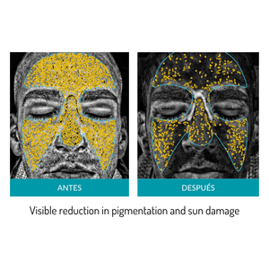 Glo Mask Anti-Aging LED Phototherapy Mask | Glo910