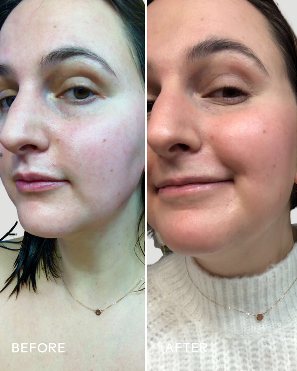 SkinHero™ Calendula + 2% Bakuchiol Bio-Retinol Serum | Three Ships