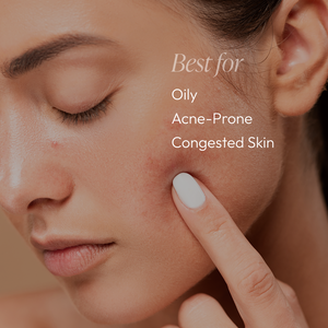 Close-up of a woman with clear skin gently touching her cheek, highlighting skin types best suited for Acne Regimen Bundle | Circadia, including oily, acne-prone, and congested skin.