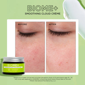 Close-up before and after comparison of skin showing reduced redness and smoother texture following use of BIOME+ smoothing cloud crème | IMAGE Skincare.