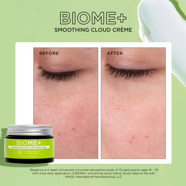 Close-up before and after comparison of skin showing reduced redness and smoother texture following use of BIOME+ smoothing cloud crème | IMAGE Skincare.