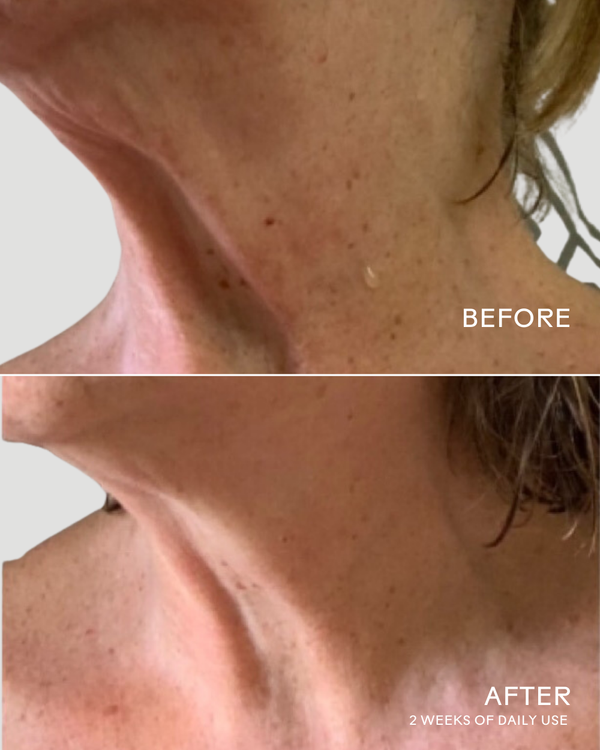 Close-up comparison of a neck and lower face skin before and after 2 weeks of daily use of Firm Believer Goji Stem Cell + Pomegranate Smoothing Neck + Face Cream | Three Ships, showing improved smoothness and texture.