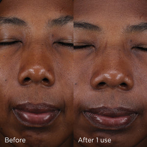 Close-up comparison of a person's face before and after one use of DAILY PREVENTION pure mineral tinted moisturizer SPF 30 | IMAGE Skincare showing improved skin tone and hydration.