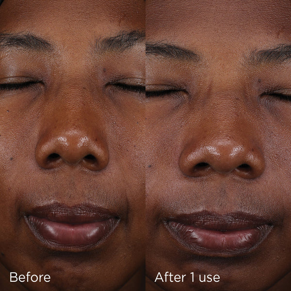 Close-up comparison of a person's face before and after one use of DAILY PREVENTION pure mineral tinted moisturizer SPF 30 | IMAGE Skincare showing improved skin tone and hydration.