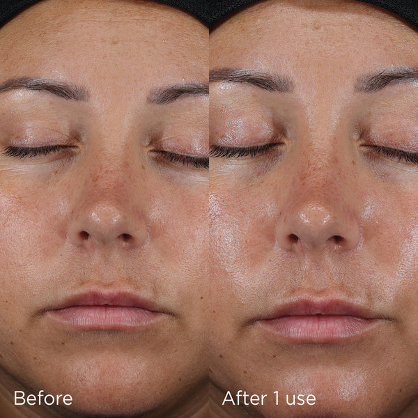 Close-up comparison of a woman's face showing visible skin improvement before and after one use of DAILY PREVENTION Ultra Defense Moisturizer SPF 50 | IMAGE Skincare, highlighting enhanced hydration and smoother skin texture.