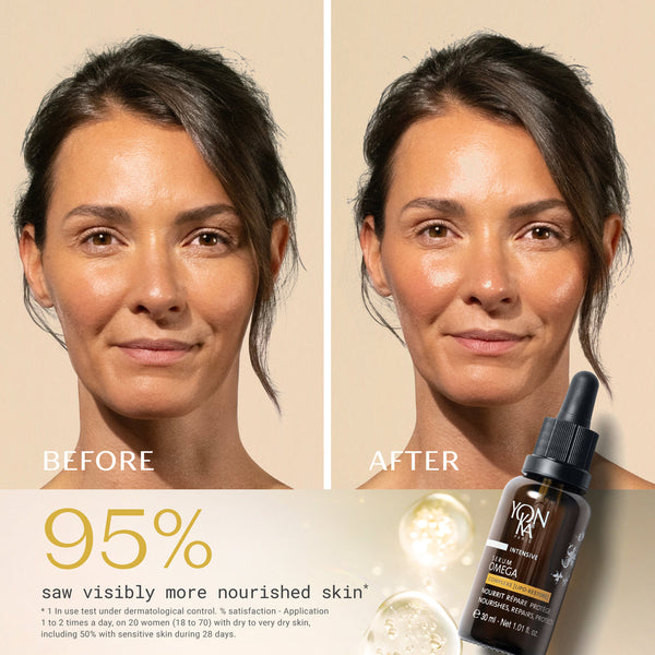 Before and after comparison of a woman’s face showing improved skin hydration and nourishment after using Serum Omega | Yon-Ka Paris skincare product.