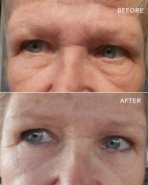 EyeHero™ Bio-Retinol Smoothing Eye Cream | Three Ships