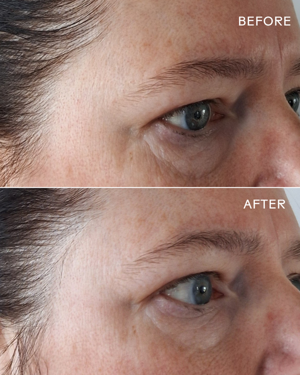 EyeHero™ Bio-Retinol Smoothing Eye Cream | Three Ships