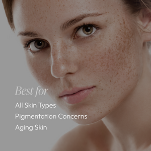 Close-up of a woman with natural freckles and clear skin, highlighting suitability of Pigmentation Essentials Regimen Kit | Circadia for all skin types, pigmentation concerns, and aging skin.
