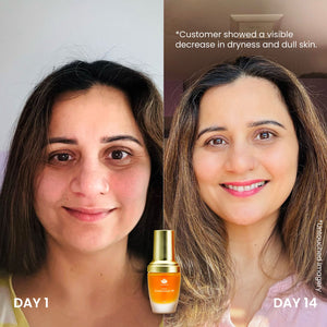 Timeless Kumkumadi Oil | Shankara