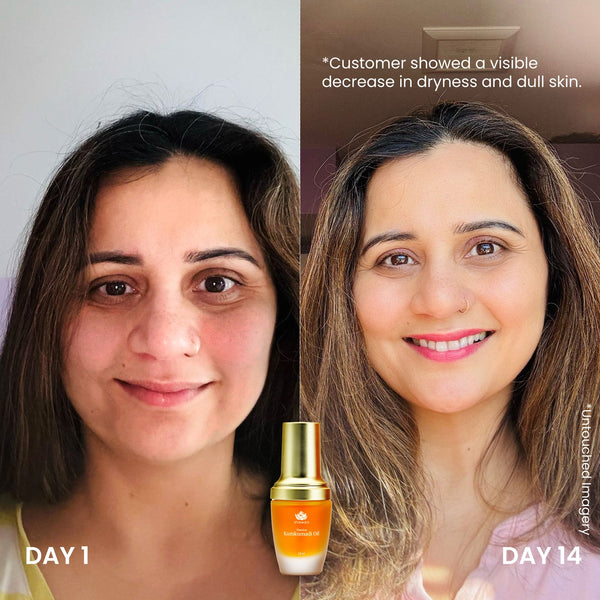 Timeless Kumkumadi Oil | Shankara