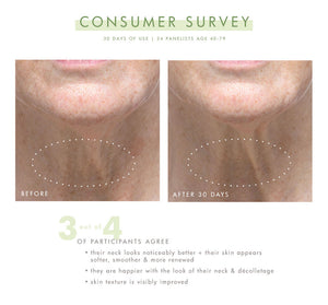 Before and after close-up images of a person's neck showing reduced wrinkles and improved skin texture after 30 days of using Necks-Level Smooth™ Cream | Farmhouse Fresh, demonstrating visible skincare results.