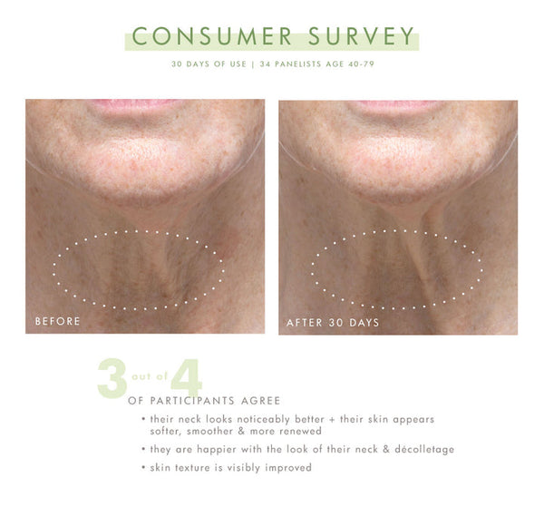 Before and after close-up images of a person's neck showing reduced wrinkles and improved skin texture after 30 days of using Necks-Level Smooth™ Cream | Farmhouse Fresh, demonstrating visible skincare results.