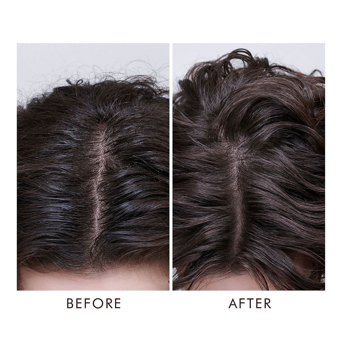 Oily Scalp Treatment | Moroccanoil