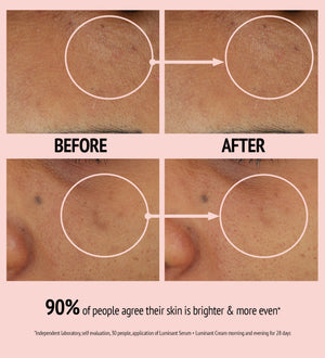 Close-up comparison of facial skin before and after using Luminant Cream | [ comfort zone ], showing visibly brighter and more even skin tone with reduced discoloration.