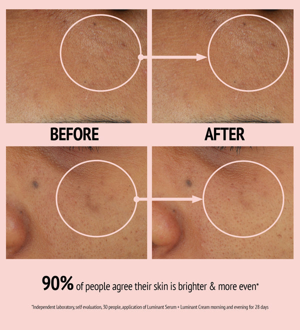 Close-up comparison of facial skin before and after using Luminant Cream | [ comfort zone ], showing visibly brighter and more even skin tone with reduced discoloration.