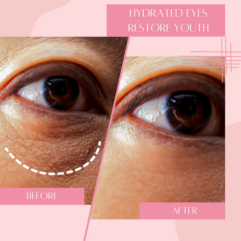 Close-up comparison of a person's under eye area showing reduced puffiness and smoother skin after using Hydrating Reusable Under Eye Patches | Dreambox Beauty, highlighting skincare benefits.