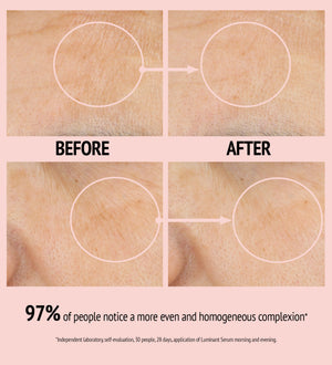 Close-up comparison of skin texture before and after using Luminant Serum | [ comfort zone ], showing improved evenness and smoother complexion in skincare results.