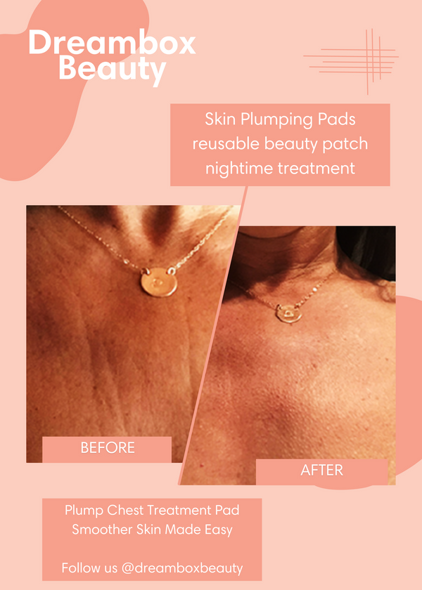 Comparison of a woman's chest skin before and after using the Skin Plumping Reusable Chest Pad | Dreambox Beauty, showing smoother and plumper skin results.