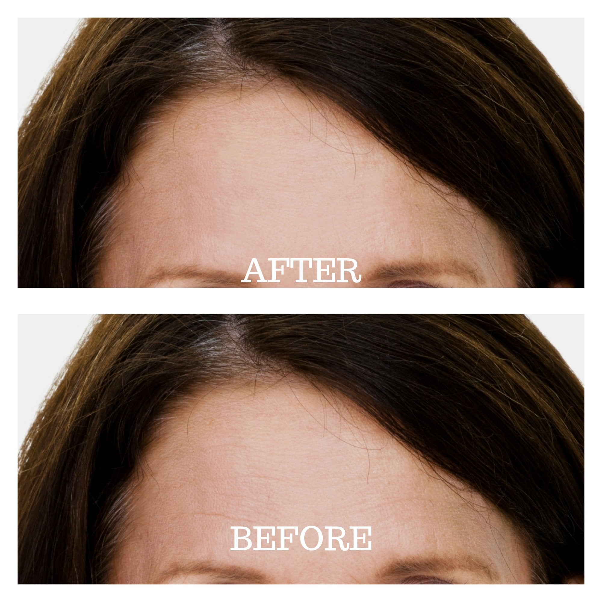 Skin Plumping Forehead Pad beauty patch nighttime treatment | Dreambox Beauty