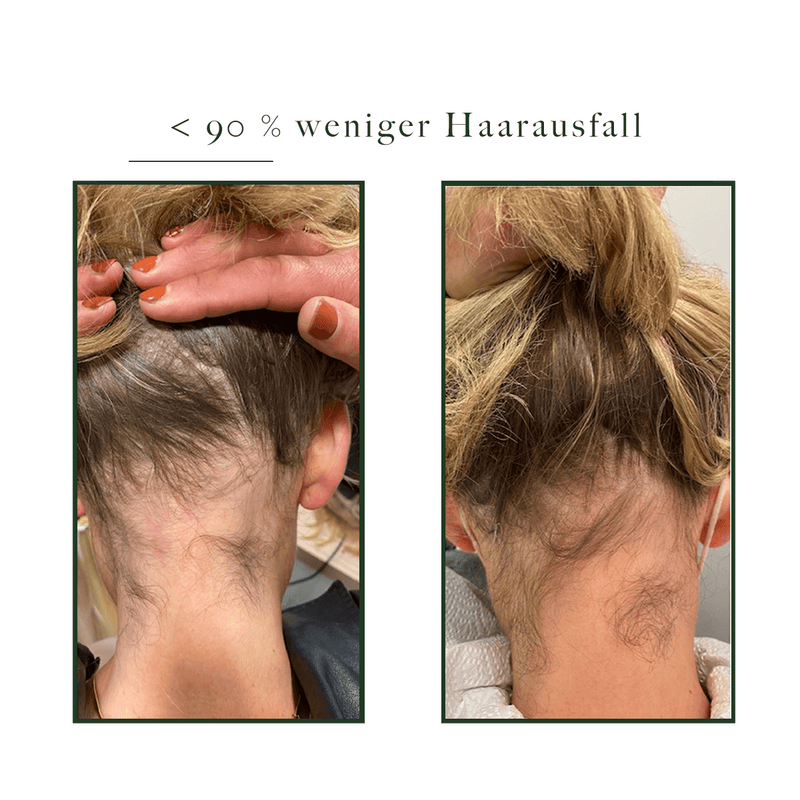 Hair Activator | Natucain