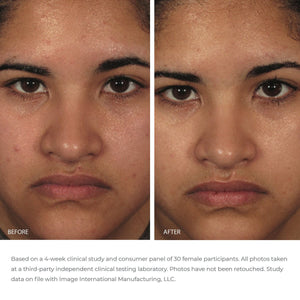 Before and after close-up comparison of a woman's face showing improved skin texture and clarity after using ORMEDIC balancing gel polisher | IMAGE Skincare, highlighting skincare results.